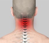 Neck Pain