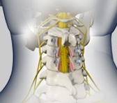 Posterior Cervical Fixation