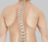 Surgery for Degenerative Scoliosis